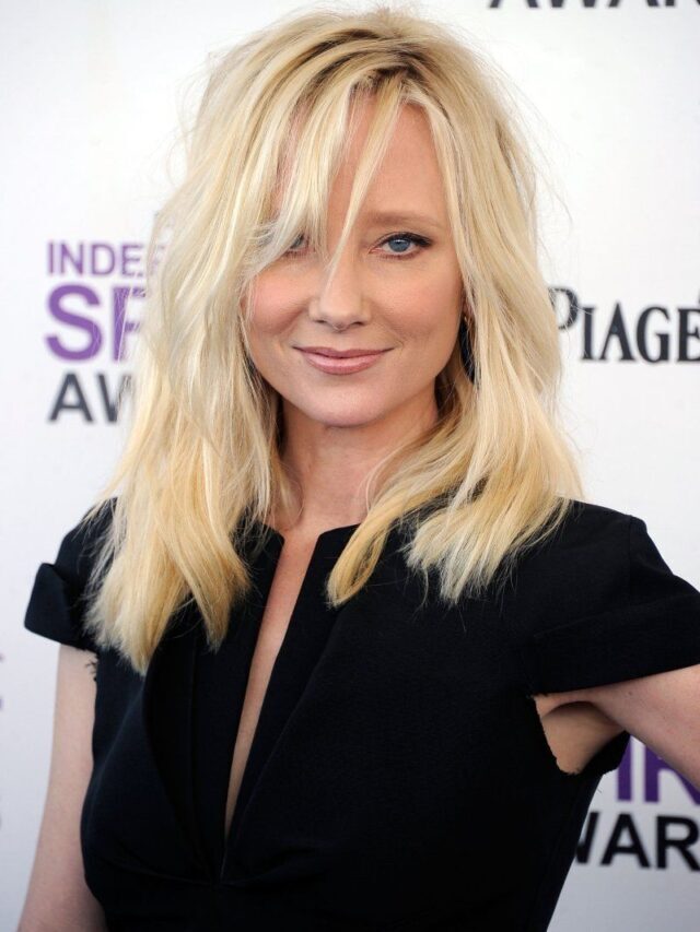 Anne Heche is in a coma and has not regained consciousness since car crash